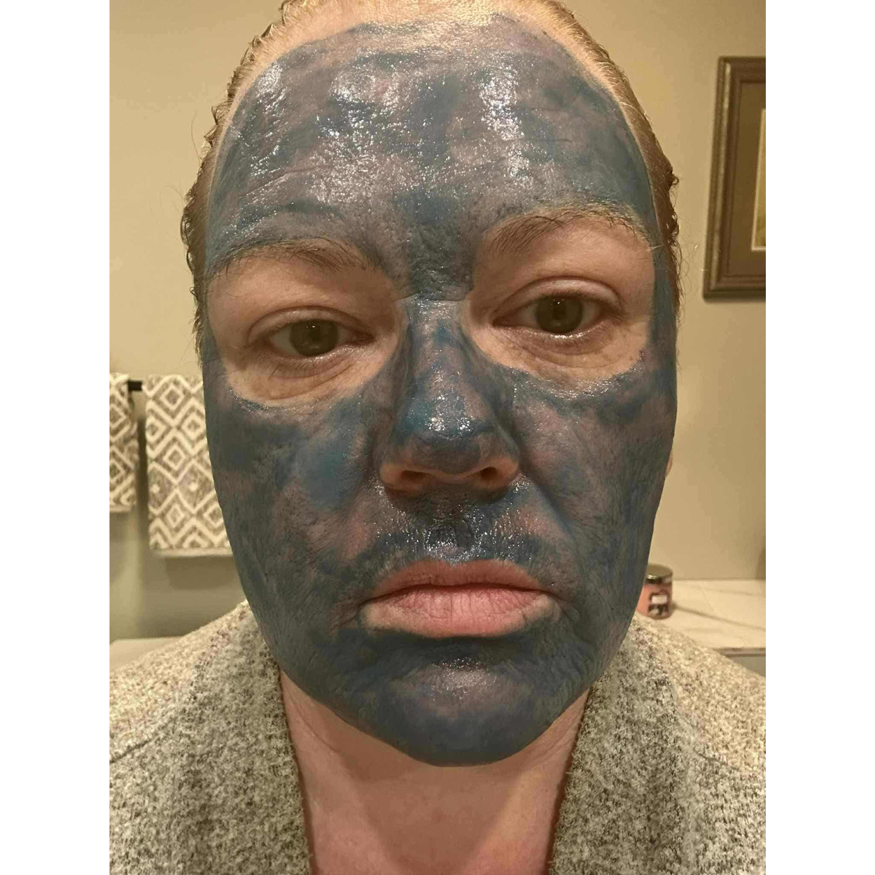 V-Sang Blue Peel (Professional use only) – Pure Pro Aesthetics V-Sang Blue Peel (Professional use only) – Pure Pro Aesthetics